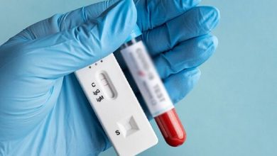 فناوری تولید کیت‌های تشخیص HIV توسعه می‌یابد